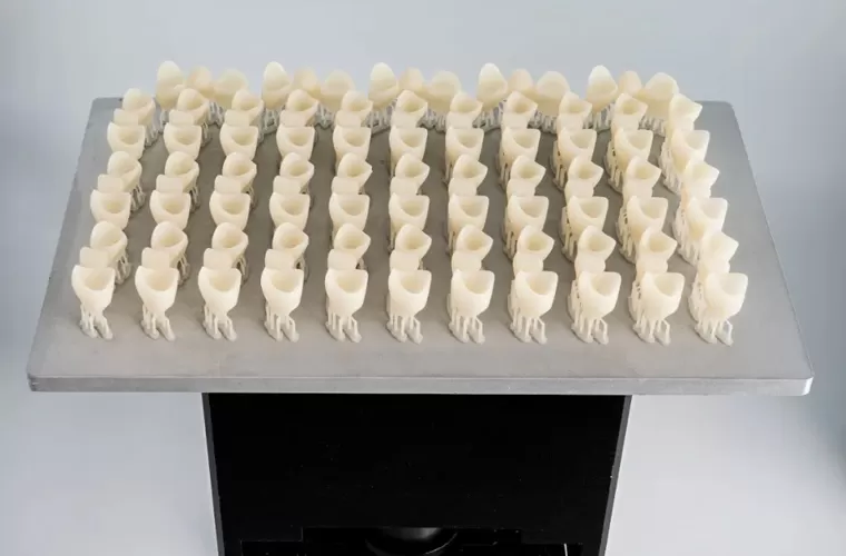 Puente y corona temporal