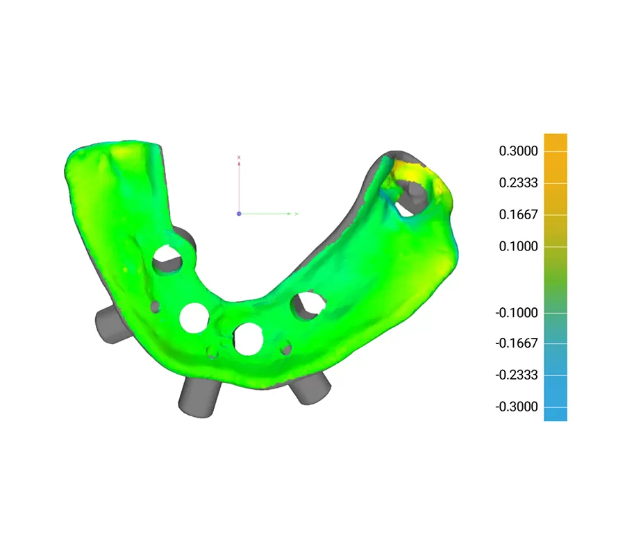 Por qué la impresora dental 3D Edge E2 es diferente