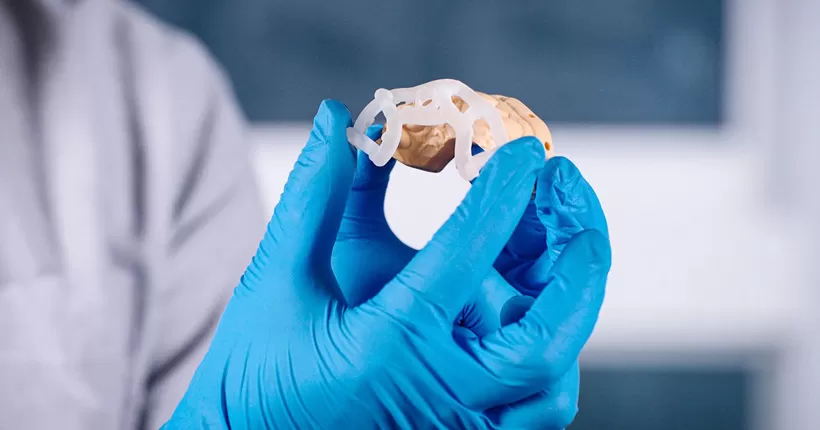 Impresión 3D de resina en odontología para guías quirúrgicas precisas e implantes dentales
